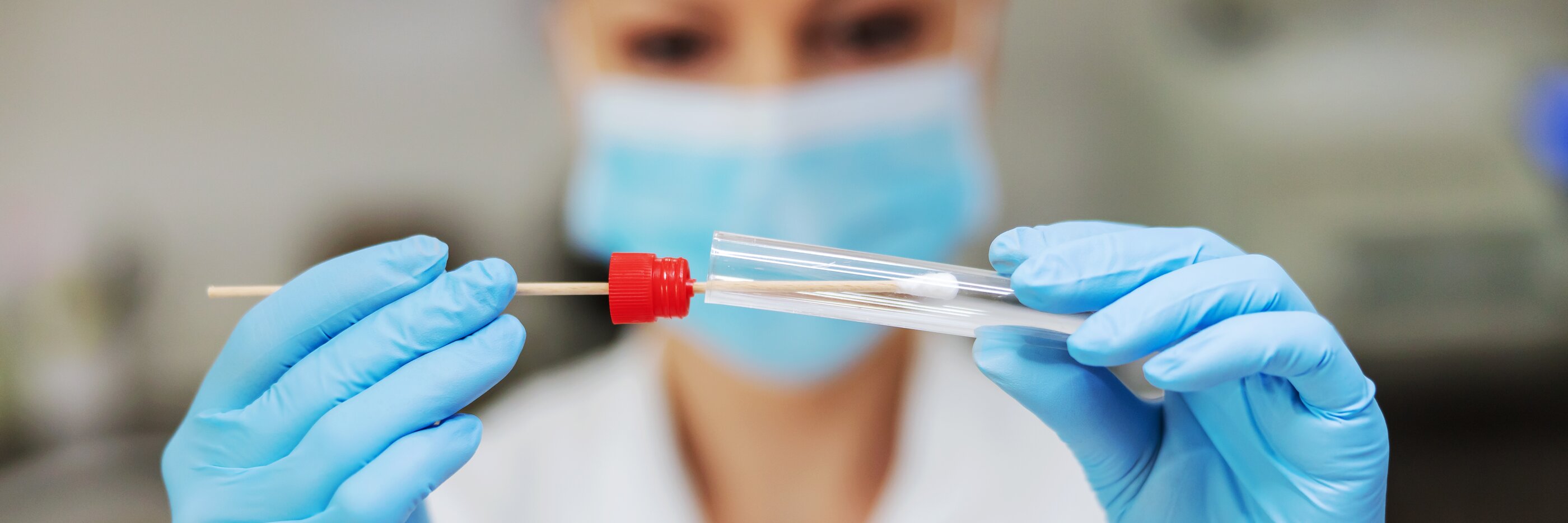 Imagebild zeigt die Anwendung eines medizinischen Test für SARS-CoV-2, vertrieben von MIKKA GmbH