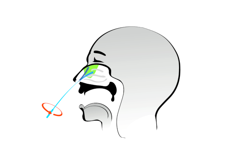 Anleitung zur Entnahme einer Probe (vordere Nase) eines SARS-CoV-2 Antigen Schnelltests von HIIGHTOP BIOTECH vertrieben durch die MIKKA GmbH | © MIKKA GmbH