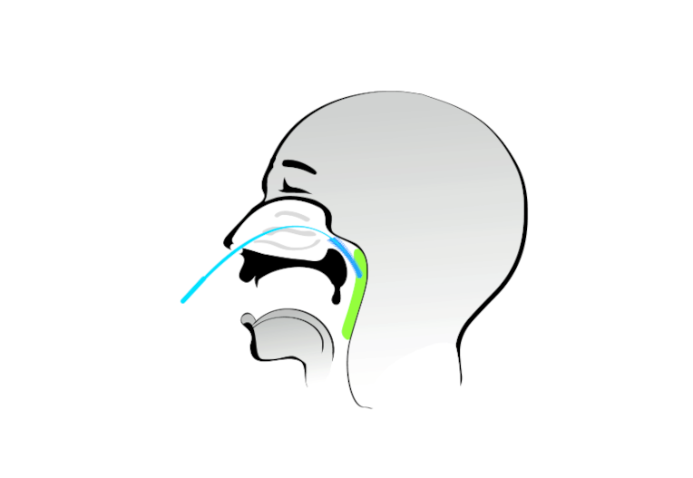 Anleitung zur Entnahme einer Probe (Nasenpharynx) eines SARS-CoV-2 Antigen Schnelltests von HIIGHTOP BIOTECH vertrieben durch die MIKKA GmbH | © MIKKA GmbH